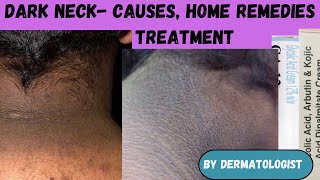 Darkneck removal creams/ home remedies/ causes