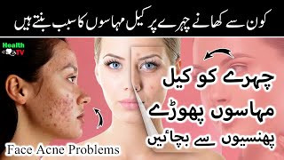 Acne Problems | Foods that Cause Skin Acne l  Face Problems | Skin Care | Face Beauty | Skin Beauty