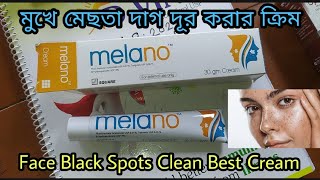 Melano Cream এর কাজ কি, দাম কত, ব্যবহার করার নিয়ম,বিস্তিরিত ভিডিও তে ।