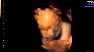 31 week 3d/4d ultrasound!