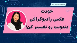 خودت عکس opg دندونت رو تفسیر کن(با هوش مصنوعی)!