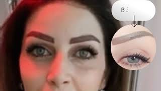 eyebrow transplant for women - Padra Medical center DXB