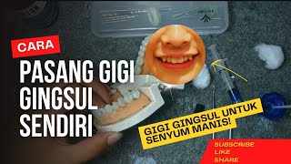 Cara Membuat Gigi Gingsul - Ini Dia Cara nya, Sangat Mudah