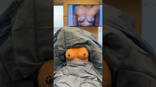 This before and after showcases the remarkable results of a breast augmentation with a lift!