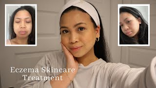 SKINCARE ROUTINE FOR DRY SENSITIVE SKIN | HOW TO HEAL ECZEMA ON FACE | NIGHT TIME ROUTINE