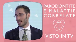 Parodontite e malattie correlate - dott. Cruciani