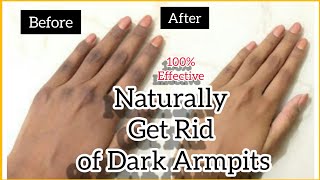 How to lighten armpits at Home? | Naturally Get Rid of Dark Armpits |