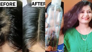 Hair Oil for hair growth। চুল পড়া বন্ধ করে নতুন চুল গজাবে মাত্র ৩ সপ্তাহে।  Home made hair oil।