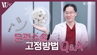 윤곽수술 고정방법 Q&A ✅