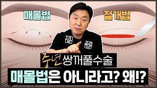 매몰쌍수vs절개쌍수, 중년에는 무조건 절개법이라고? 왜? ㅣ 매몰쌍수vs절개쌍수 고민 이 영상으로 종결! - 의학박사 백승준