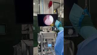 Hock Arthroscopy with Dr. Alvaro Bonilla at TEH