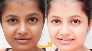 Sun Tan Removal Home Remedy |Remove Sun Tan From Your Face, Neck, Hands | Quick Result |