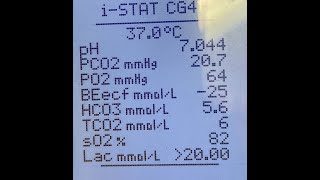 Metabolic Acidosis March 2022 Blood Gas:Case