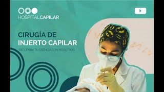 💁🏼‍♂️Conoce HOSPITAL CAPILAR |  ¿Qué podemos hacer por ti? 💯