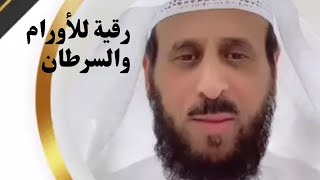 رقية للأورام السرطانية فهد القرني