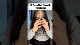 🌿15 Days Hair Growth challenge/Bhingaraj oil se kare apne choti ko moti#RiseBeauty#viral shorts