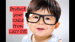 PROTECT your children from LAZY EYE/ #lazyeye #lazyeyes #amblyopia