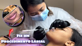 DAILY VLOG: GRWM, Neutralização Labial & Pós procedimento labial 💜✨