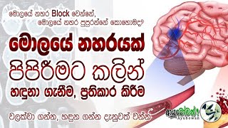 මොලයේ නහර Block වෙන්නේ සහ පුපුරන්නේ කොහොමද?මොලයේ නහර පුපුරන එක වලක්වගන්නේ කොහොමද |MLT AnushikaPerera