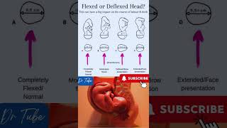 Flexion of head in labour | सिर का झुकना #pregnancy #head #baby