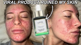 This VIRAL Product RUINED My Skin