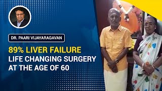 89% Liver Failure | Life Changing Surgery at the age of 60