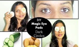 DIY- Magic eye pads for dark circles | Eye puffiness | Eye itching |