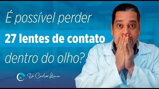 É possível perder 27 lentes de contato dentro do olho?