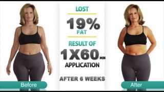 Marcy Before & After Story freezing fat at home with SlimFreezer