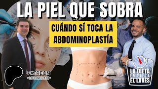 LA PIEL QUE SOBRA, CUÁNDO SÍ TOCA LA ABDOMINOPLASTÍA