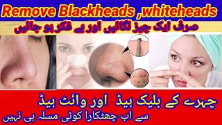 Remove blackheads and white head | neat skin |blackheads remover |