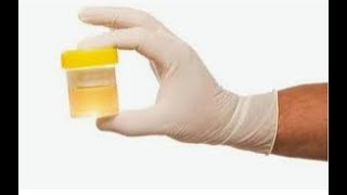 RACCOLTA delle URINE per SCOPO DIAGNOSTICO. ELIMINAZIONE. CORSO OSS. Futuri OSS)))))