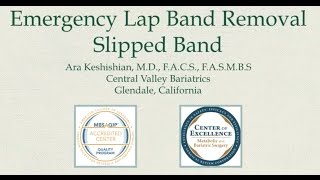 Slipped Band  Emergency