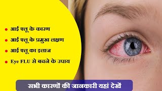 Eye Flu क्यों होता है | Eye Flu के लक्षण क्या है | Eye Flu का घरेलू इलाज | Eye Flu से बचने के उपाय |