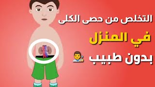 6 طرق طبيعيه في المنزل للتخلص من حصى الكلى بدون طبيب