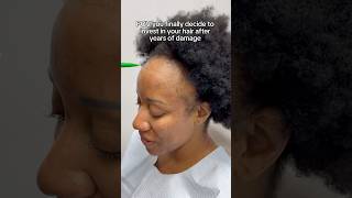 POV You Finally Decide to Invest in Your Hair! #hairgrowth #hairlosssolution