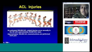 Presentation on Anterior Cruciate Ligament by Dr Anna Chacko