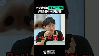 코성형 했는데 코가 빨개졌다?!