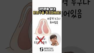 비염수술 하기 전 체크사항 #shorts