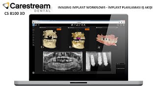 Carestream CS 8100 3D Imaging Implant Workflows - İmplant planlaması iş akışı