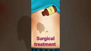 Surgical treatment #shorts #youtube