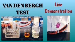 Van den bergh test || Diazo test || Bile pigments in urine || #Biochemistry