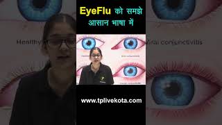 eyeflu ko pahchane #eyeflu #shortsvideo #ytshorts