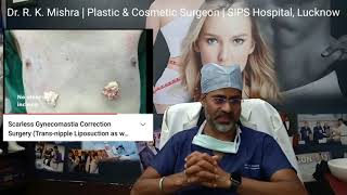 Daddy Makeover | Liposuction for Men | Gynecomastia Correction | Best Plastic & Cosmetic Surgeon