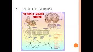 Potenciales evocados y monitoreo Dra Corti