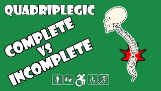 Complete vs Incomplete Spinal Cord Injury Explained | Quadriplegic (C5,C6,C7)