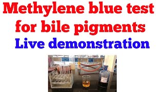 Methylene blue test for bile pigments || #Biochemistry