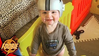 WE ARE BACK FOOBIE!! WHY OUR SON HAS A DOC BAND HELMET!