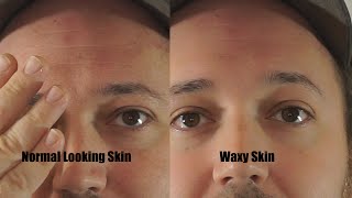 (Everything you've ever needed to know about) The Sony Waxy Skin Bug