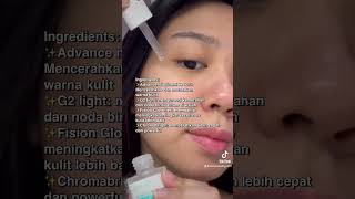 Serum 20rb an yang bisa mengatasi permasalahan kulit kamu  #skincare